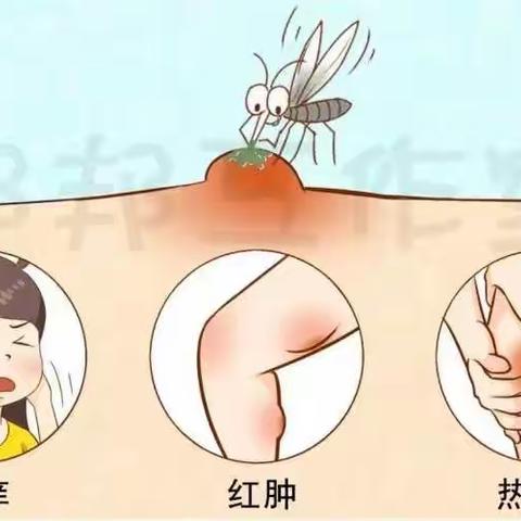 热痱、湿疹、皮炎、蚊虫叮咬...宝宝夏季常见皮肤问题怎么破？