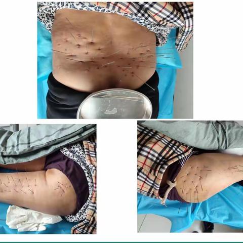 《软组织疼痛精准诊疗模式临床应用案例分享》～颈肩腰腿痛诊疗组首席专家唐晨供图。公益咨询：4008208048