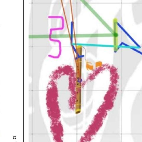 “模板星线牌”演绎“社戏”感动。