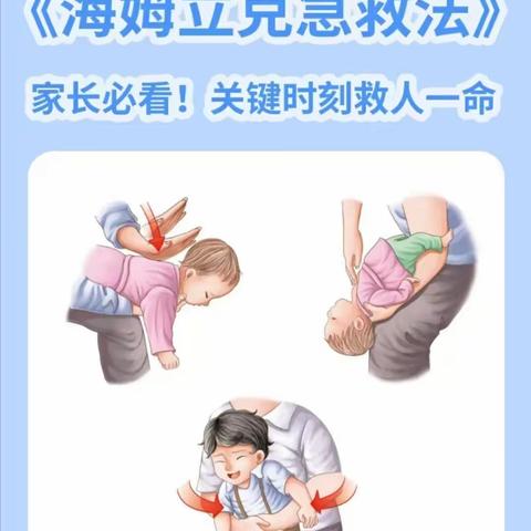 小太阳晨旭幼儿园保健护理—海姆立克法急救