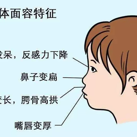 小疾病，大危害—儿童鼾症，您了解多少？