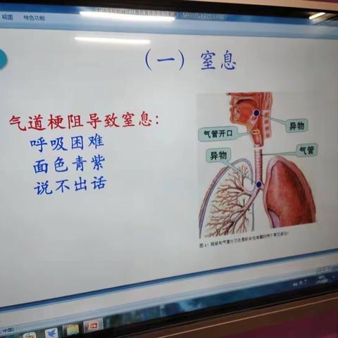 预控意外伤害,我们在行动——中堡镇徐家店幼儿园举行意外伤害培训活动