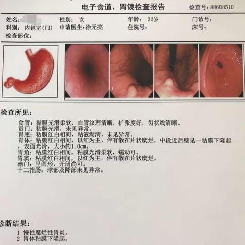 罗山县人民医院消化内镜技术新高度—粘膜下肿物切除术