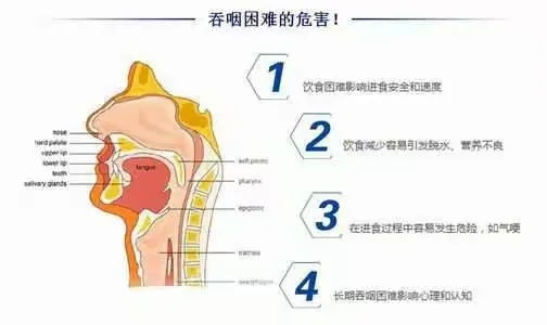 吞咽困难康复指导