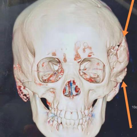 神经临床再开花 名医名家展才华