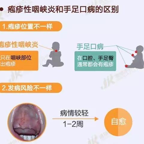 最近高发，请家长注意⚠️—南坑镇中心幼儿园