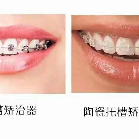 矫正牙齿的误区