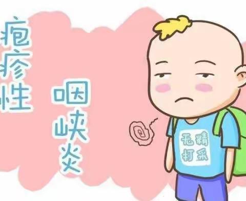 【太阳城幼儿园——保健小课堂】♥宝宝得疱疹性咽峡炎咋办？