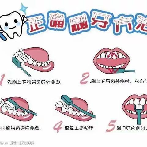 护牙行动，从齿开始——碧桂园幼儿园西苑分园