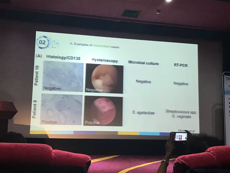 子宫内膜炎文献（蔡贺）