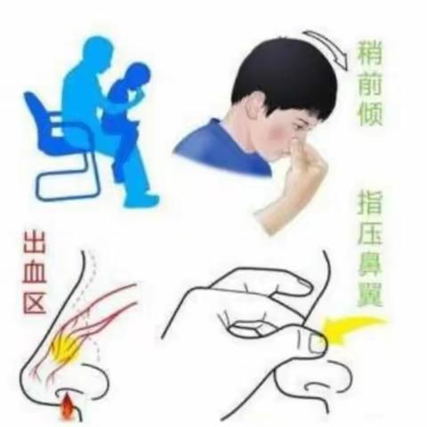 幼儿流鼻血怎么办？