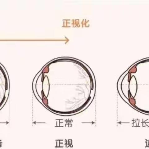 “注重行为干预，融入日常生活”——泽洋幼儿园爱眼护眼宣传