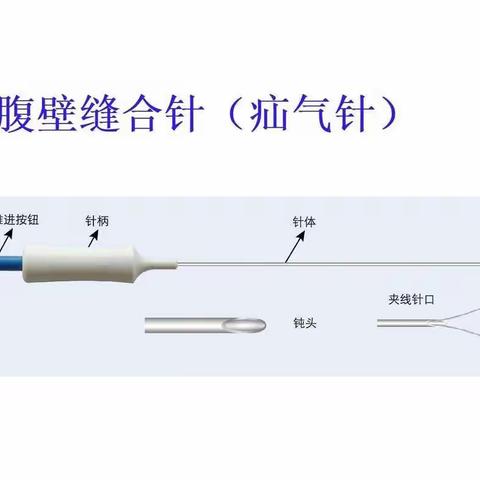 单孔腹腔镜小儿疝囊高位结术