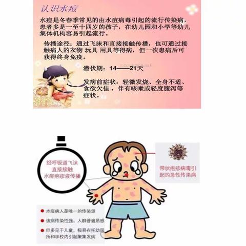 水痘传染病小知识宣传