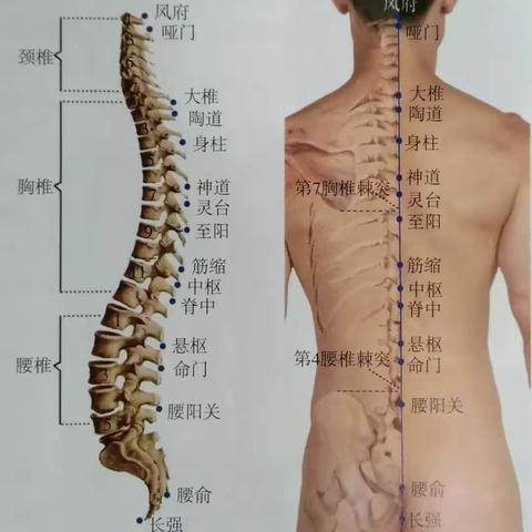 信阳市中医院内科督灸正当时