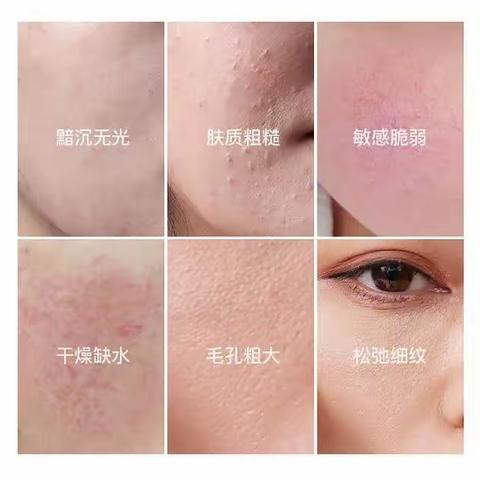 拯救熬夜危“肌”！还得是你