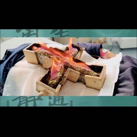 三九冬灸 健康长久