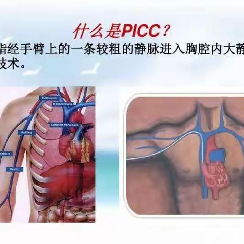 关于静脉输液那些事儿…