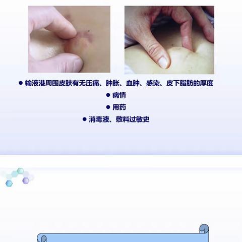 天ヽo使KIss的美篇