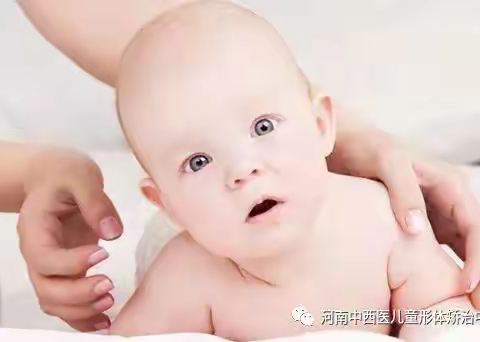 警惕宝宝的歪脖