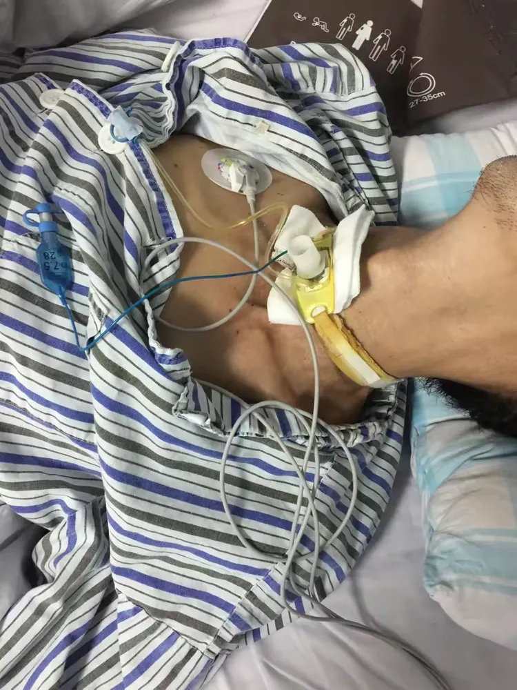从浅昏迷---嗜睡---神志清楚经历了20来天，这里面少不了医生和护士的辛劳和付出，我们邀请朱医生为