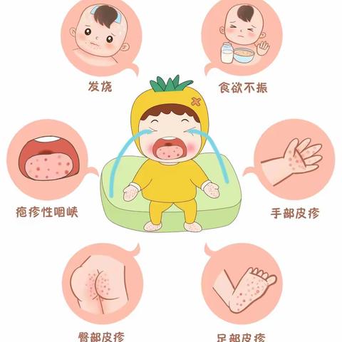 【健康指南】幼儿园手足口病预防——和乐幼儿园
