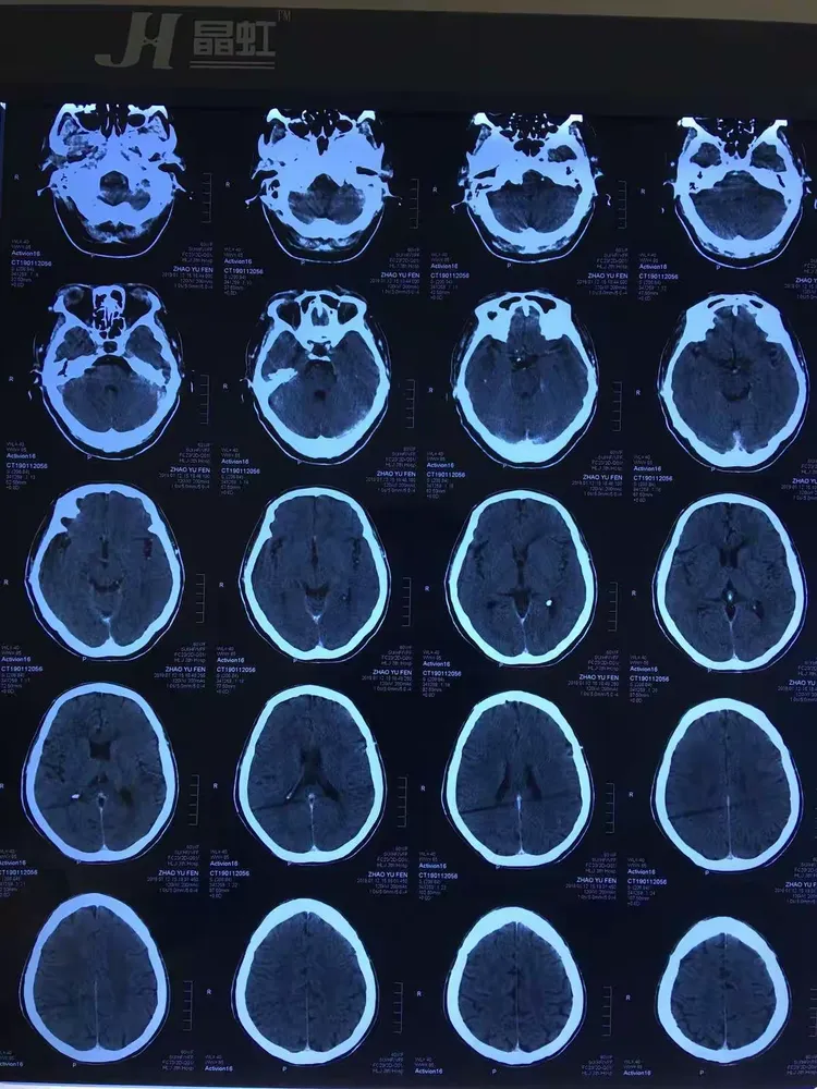 北京大学第三医院挂号平台CT加急-北医三院app网上预约挂号几点放号 
