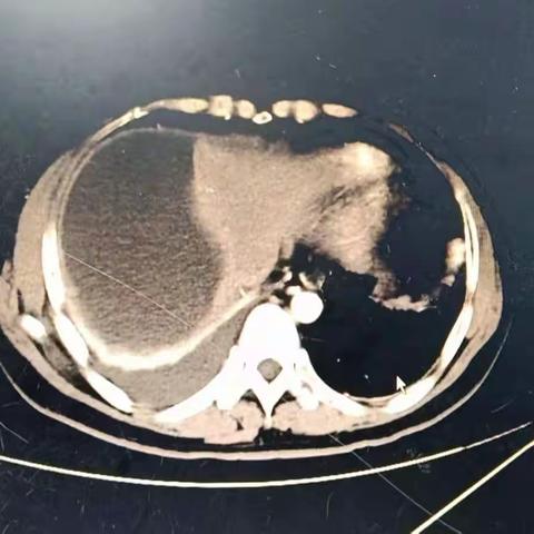 养病如养虎 小病不医成大患