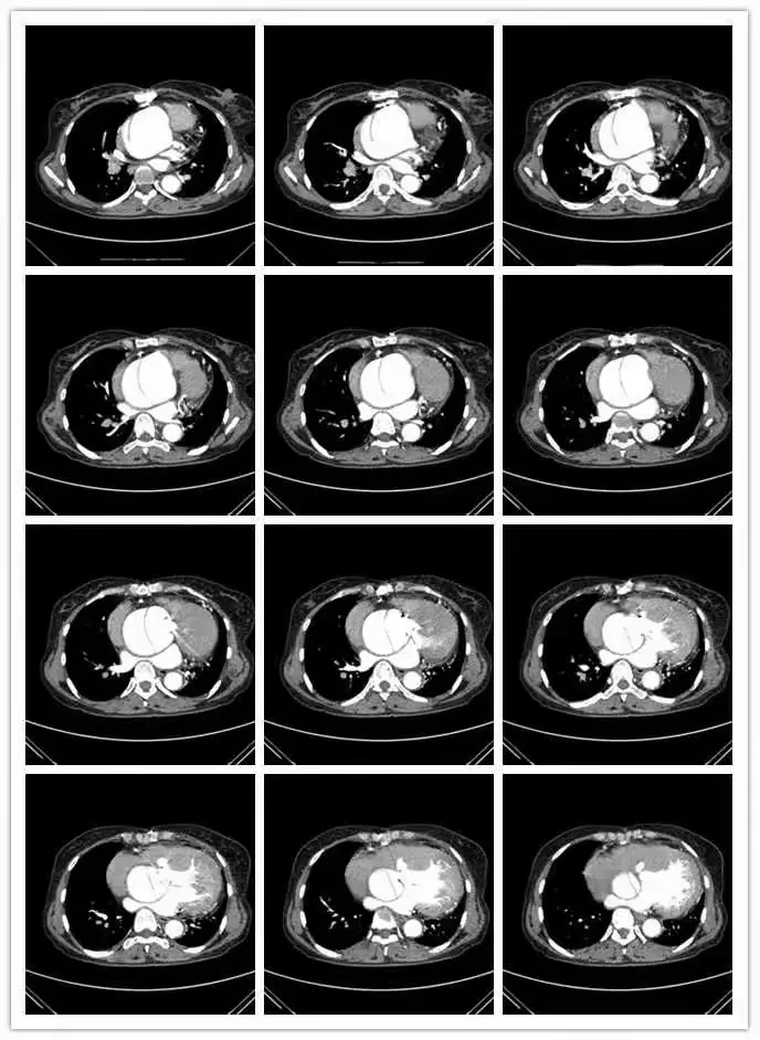 为什么来大姨妈有黑色的血块百科在线 为什么来大姨妈有黑色的血块百科在线