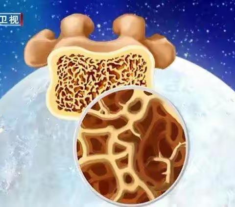 【健康分享】--这些常吃的食物竟会“偷走钙”！补钙的“最佳方式”，让你事半功倍~