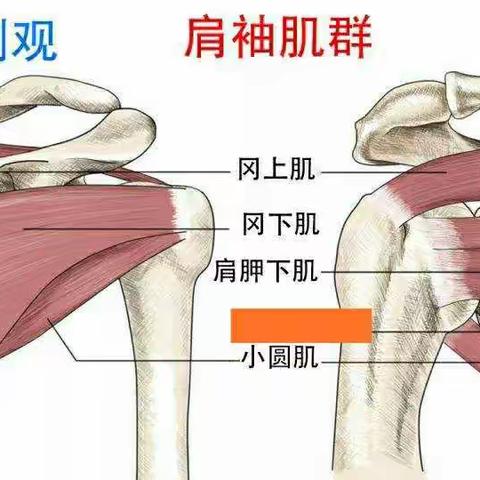 不可忽视的肩痛—肩袖损伤