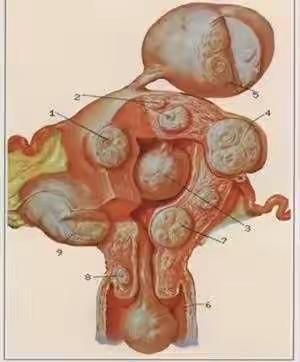 六医妇科科普（四）妇女子宫上长瘤子都是良性的吗？