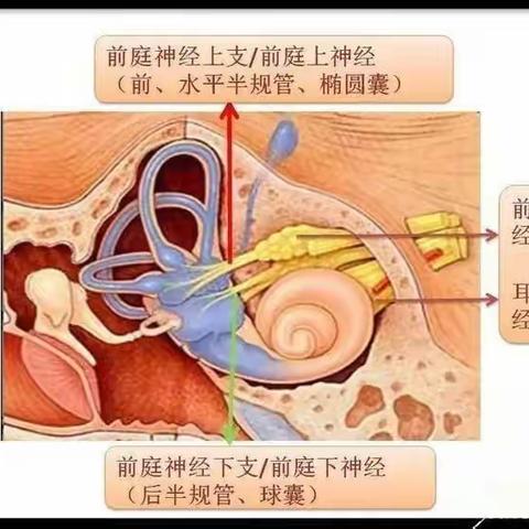 眩晕科普 —前庭神经炎