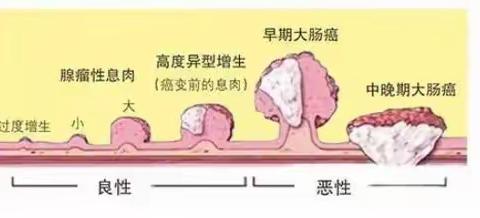 肠镜病理报告解读