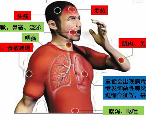 卧牛河镇中心幼儿园秋冬季常见传染病预防指南