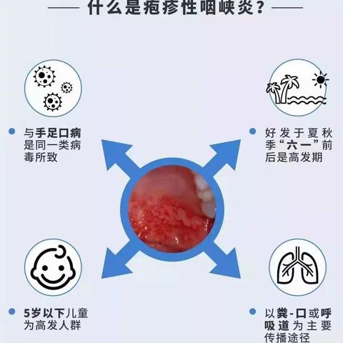 渝海大地幼儿园【卫生保健】——疱疹性咽峡炎的症状及防治知识