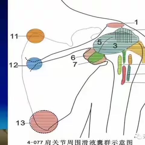 肩周炎的针刀与手法治疗肩周炎的针刀治疗