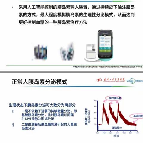 微泰贴敷式胰岛素泵的使用