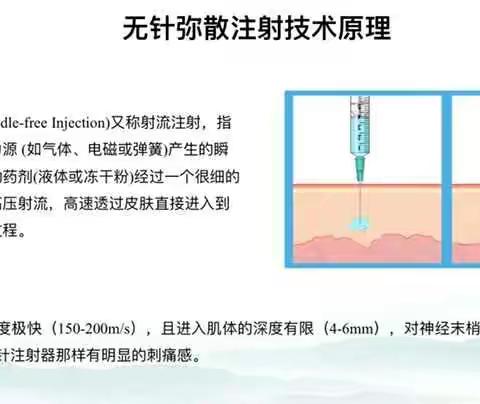 无针注射器的使用