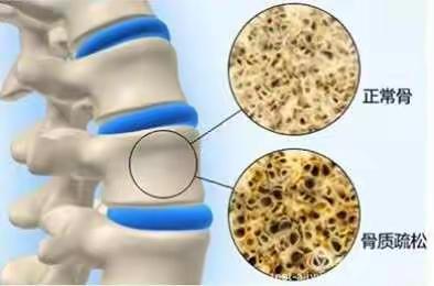 花需润土 骨需汝养