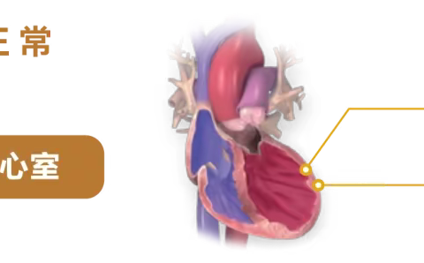 心衰知识系列1—什么是心衰？