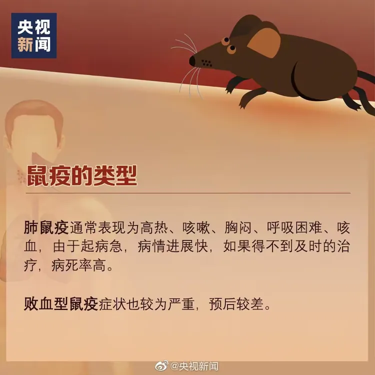 鼠疫的症状传播途径有哪些？如何预防？