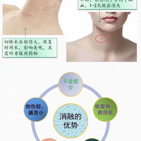 以学促行 以行践学——超声引导下射频消融术