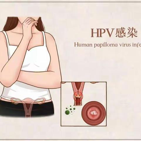 没有性生活也能感染HPV？（副本）