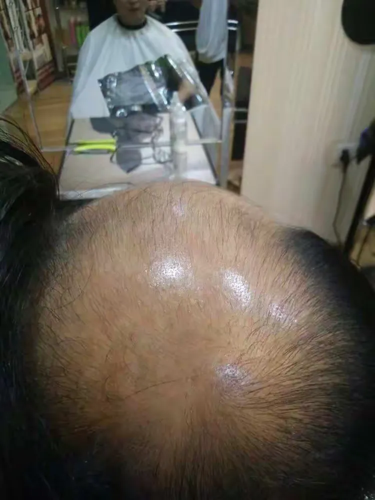 植物草本育发古方 生发 养发 防脱 无效退款