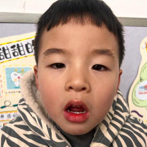 【竹幼课程】冬日皮肤的秘密——小一班项目课程