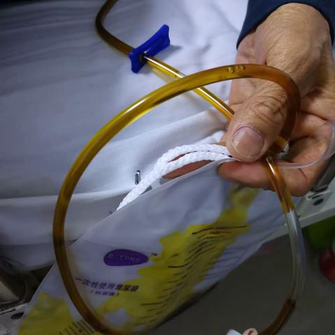 疫情无情  人有情   超声介入解病痛