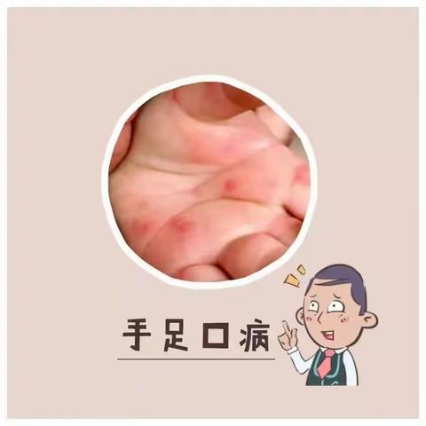 常见传染病预防宣传