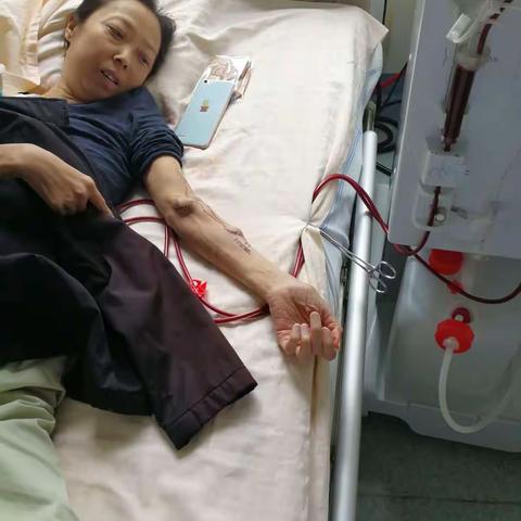 高位瘘术后的相关问题