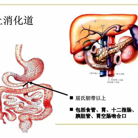 上消化道出血你了解多少呢？